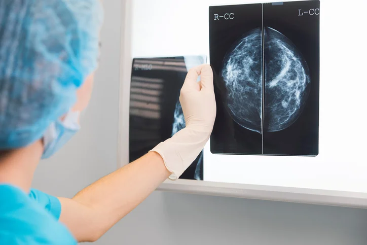 Here’s what your breast pain may be revealing