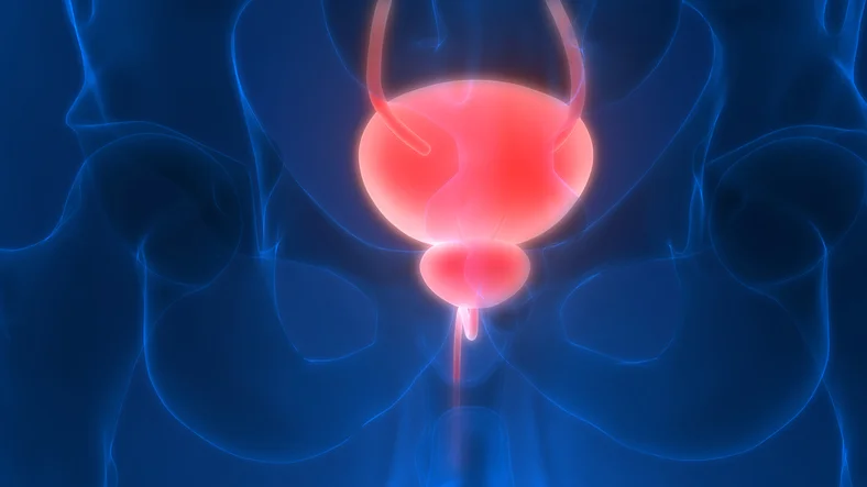 When nerve damage causes neurogenic bladder