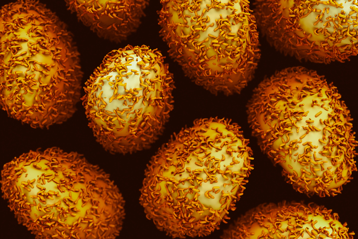 Here are six evidence-based steps to take reducing the risk of colorectal cancer: