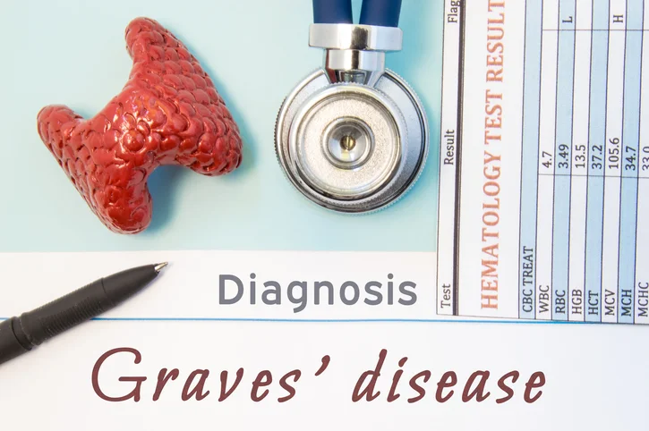 Graves’ disease – a common form of hyperthyroidism