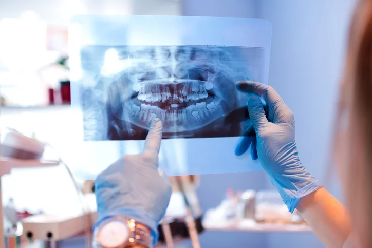 5 reasons why men have more dental problems
