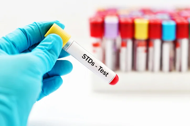 7 best ways protecting yourself from an STD