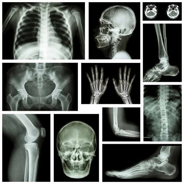 9 things you’re doing weakening your bones