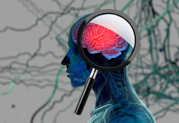 How to tell differences between normal aging and Alzheimer’s