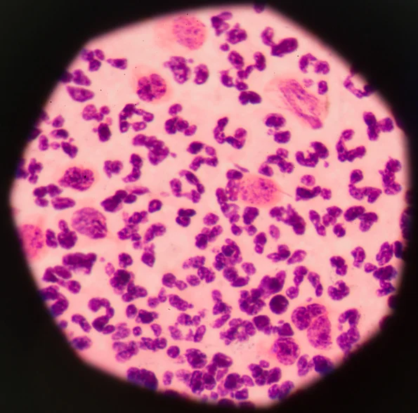 4 reasons to put sex on hold when dealing with a yeast infection