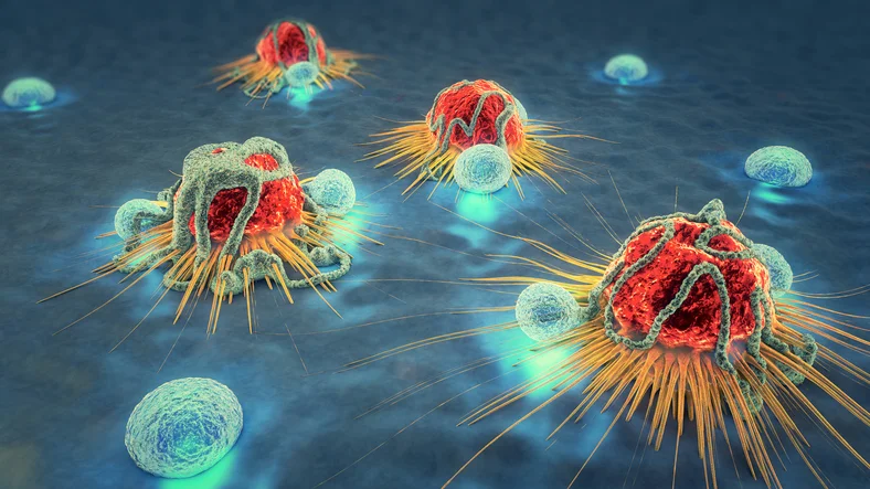 Study shows declines in diagnoses of metastatic prostate cancer