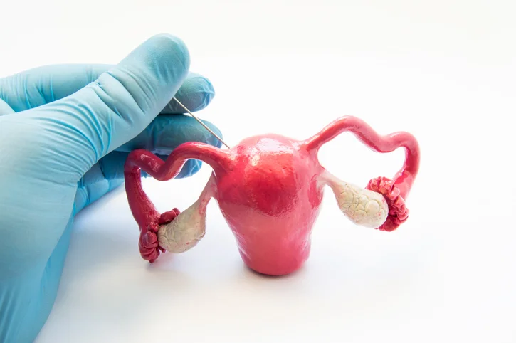 Important facts women should know about ovarian cysts