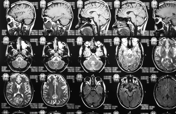 Reducing radiation risk from imaging tests