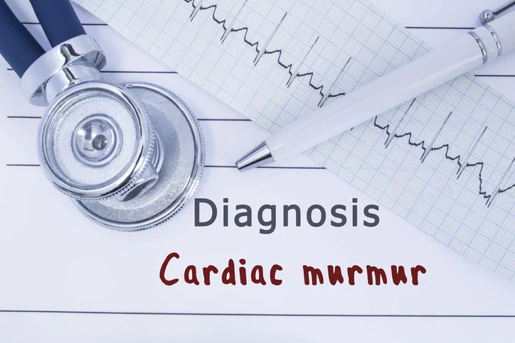 Answers to questions you have about heart murmurs