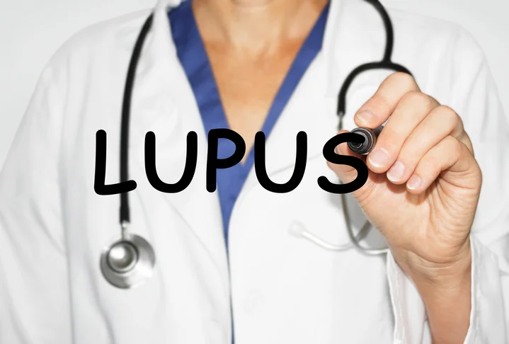 Lupus – A silent killer among young women