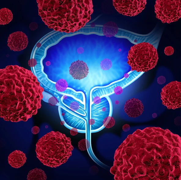 When should men consider active surveillance for prostate cancer?