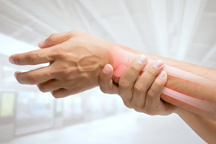 Top 5 facts to know about rheumatoid arthritis