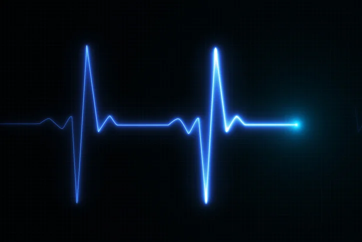 Exercise precautions when you have atrial fibrillation