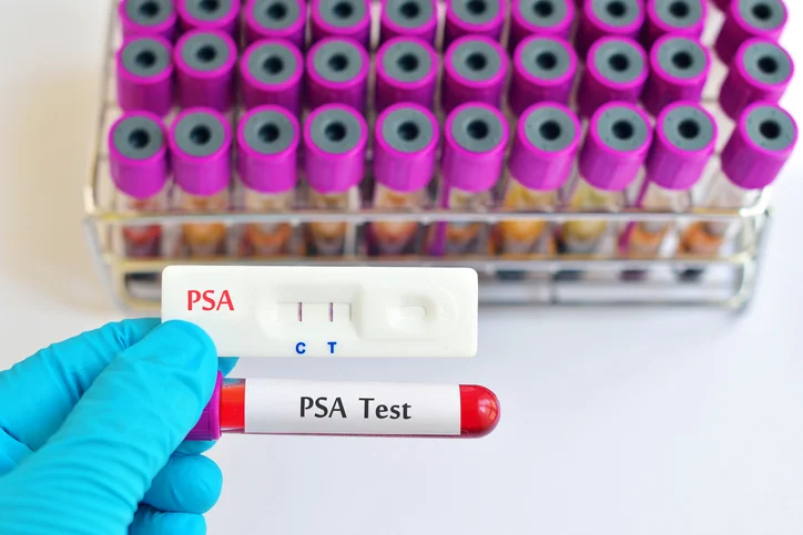 7 tips urologists recommend protecting the prostate