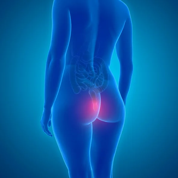 Help for hemorrhoids