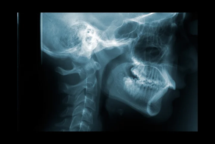 Warning signs of head and neck cancers