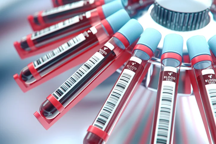 New blood test appears more accurate and promising for reducing unnecessary prostate biopsies