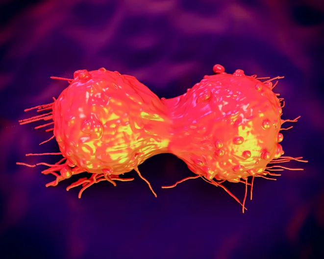 Understanding precancerous changes of the cervix