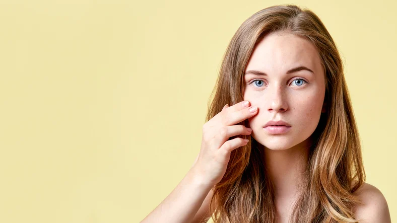 5 things you’re doing making adult acne worse