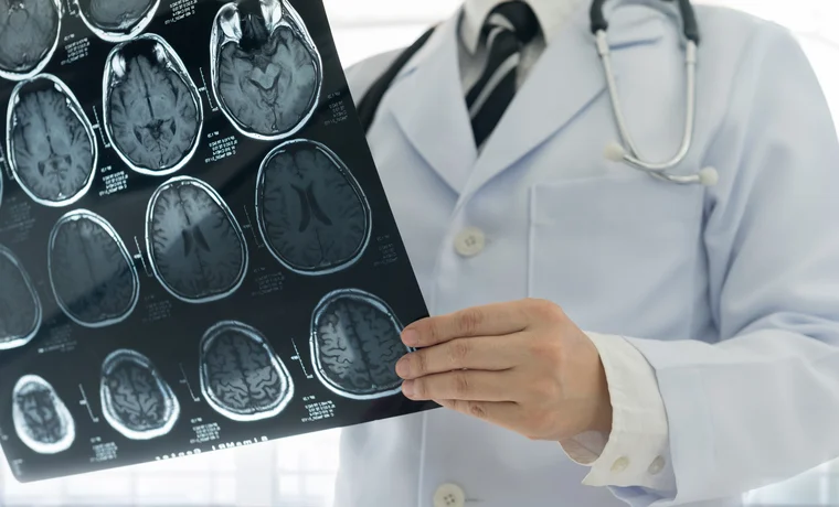 Life after a stroke