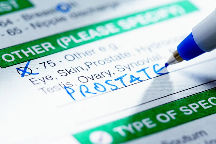 8 causes of an elevated PSA besides prostate cancer