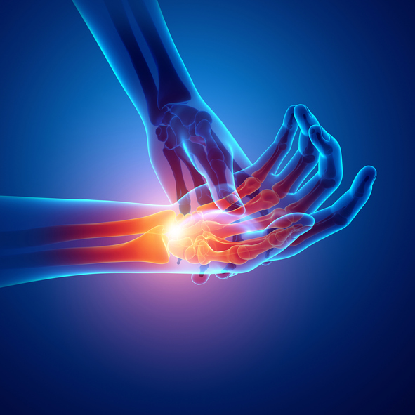 Getting a grip on arthritic hand pain