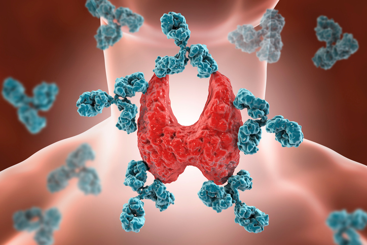 Everything you need to know about Hashimoto’s disease