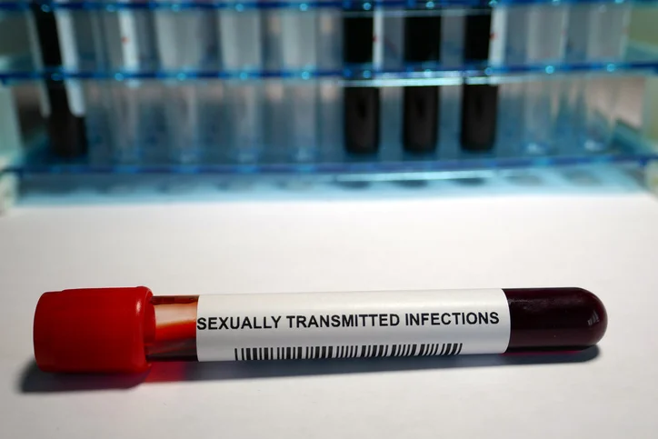 Penis-related symptoms of an STD