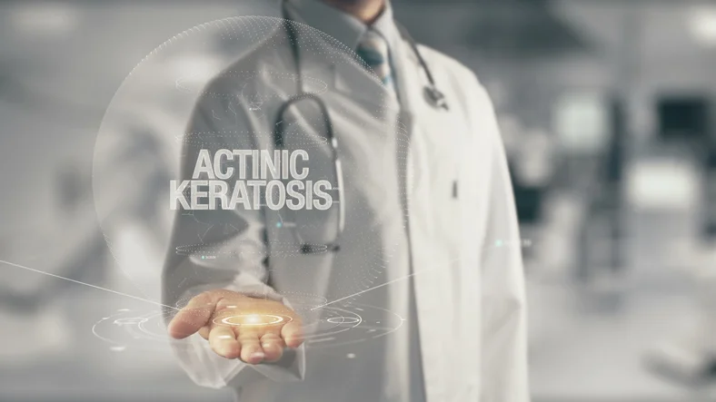 Spot-on information on actinic keratosis 
