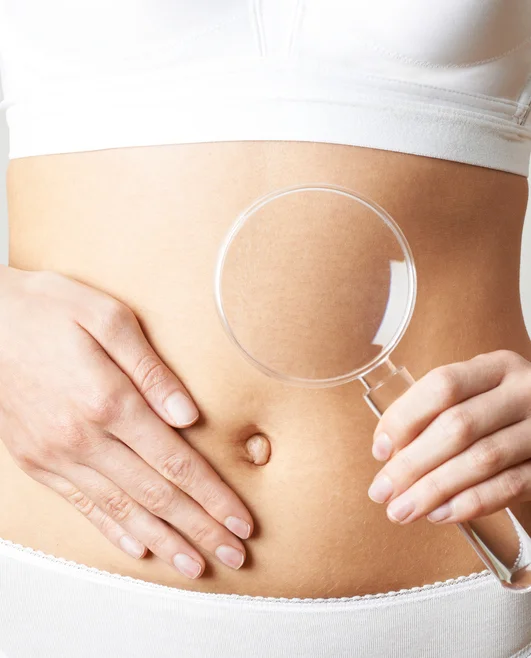 Why a FODMAP diet is your answer to treating IBS