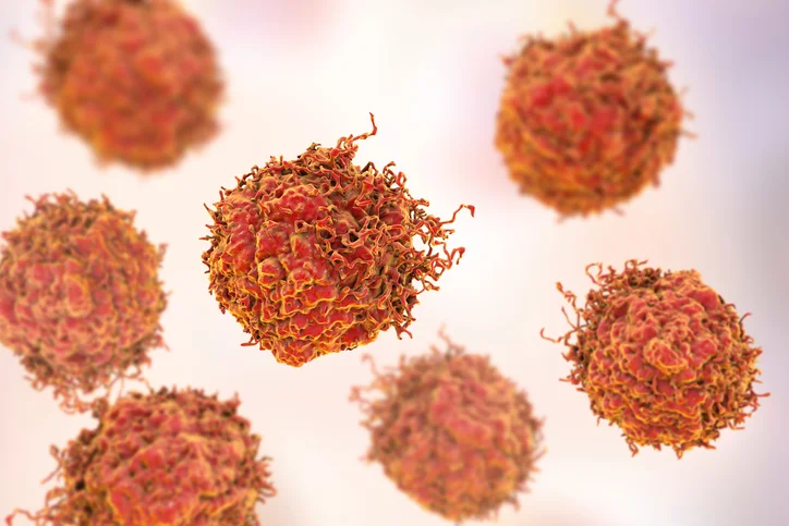 Statin use may reduce mortality in prostate cancer