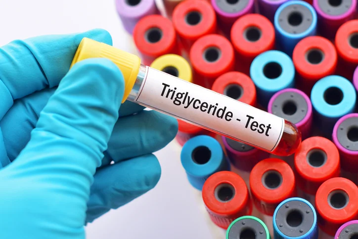 10 simple steps to lower your triglycerides