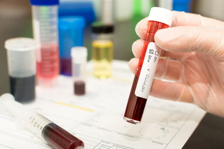 Learn the differences between Hepatitis A, B, & C