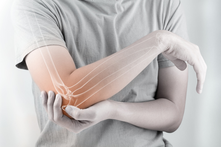 10 key differences between osteoarthritis and rheumatoid arthritis