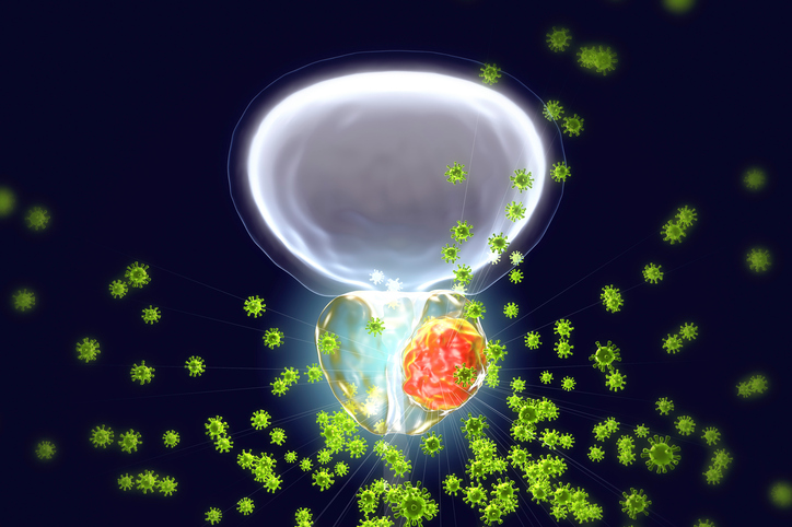 Understanding active surveillance for prostate cancer