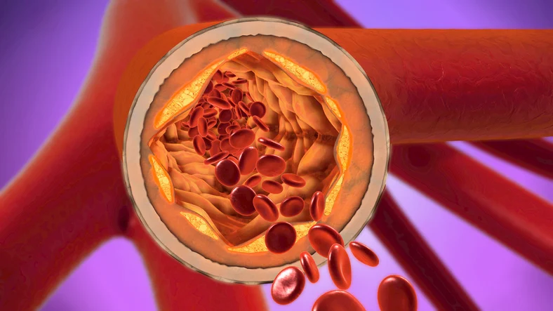 Anti-age your arteries with 7 simple steps