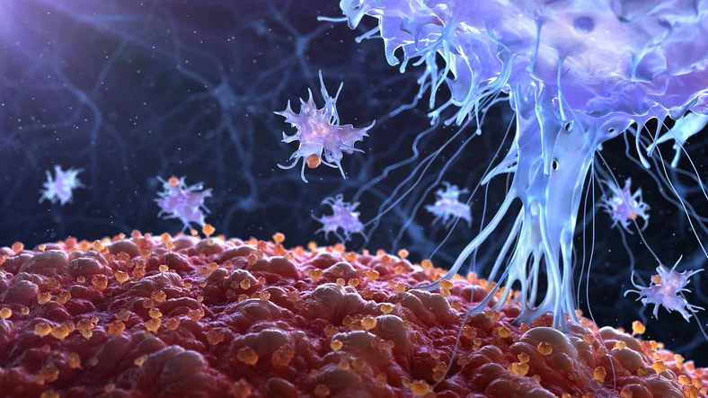 Grading prostate cancer with the Gleason Score