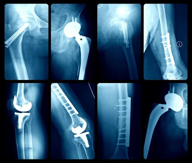 Dos and Don’ts when living with knee pain