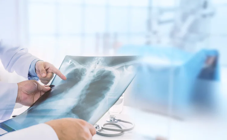 Pneumonia 101: Facts you need to know 