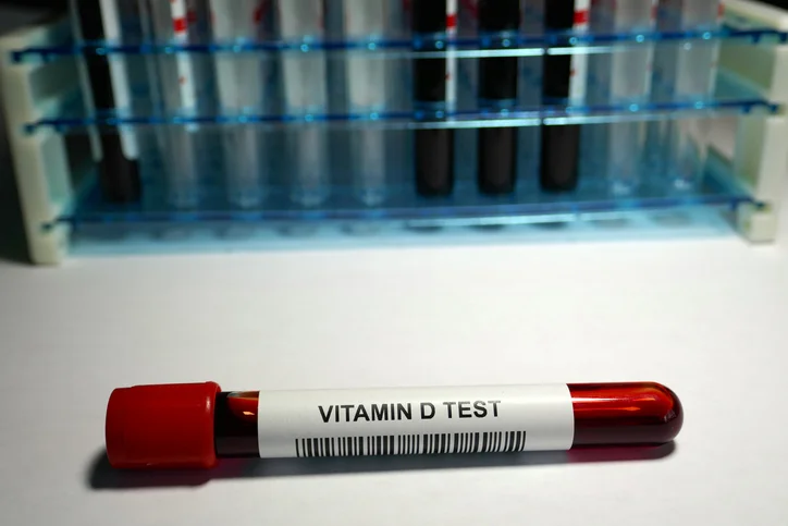 10 Ways to get calcium and vitamin D if lactose intolerant