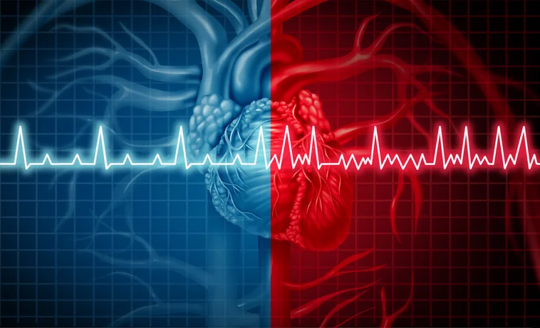 Living with atrial fibrillation