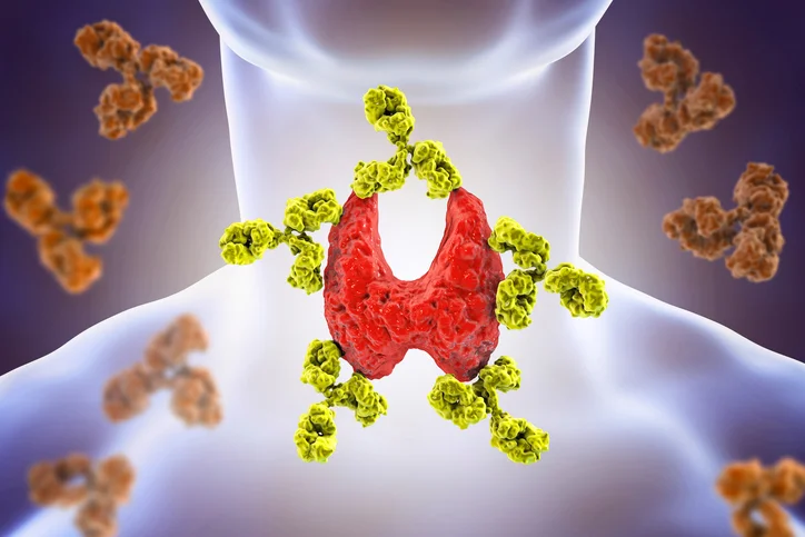 Women and Hashimoto’s Disease&nbsp;