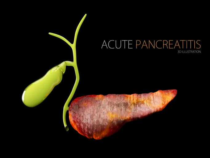 Treat mild pancreatitis with a proper diet