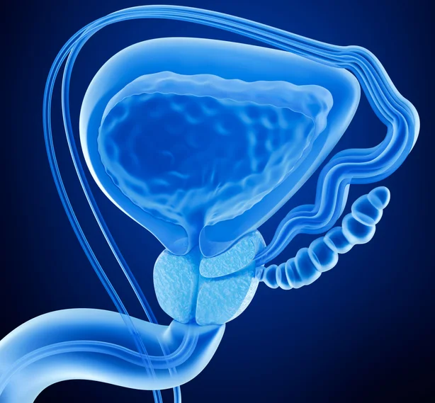 Prostate cancer growth dramatically reduced with new compound