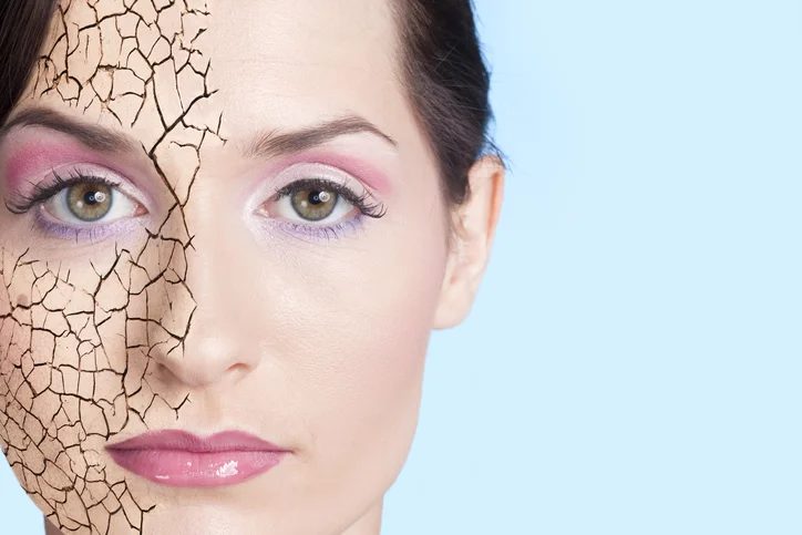 Skin conditions indicating diabetes