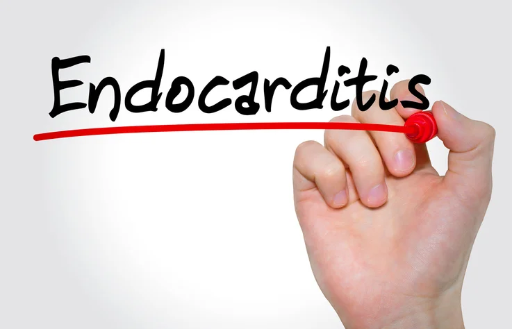 Bacterial endocarditis: A heart infection to take seriously