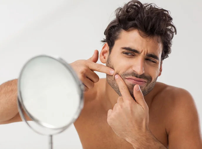 That Acne in men: Causes and cures