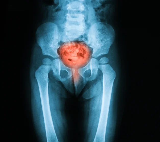 The effect of aging on your bladder&nbsp;