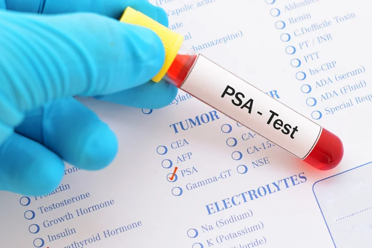 Here’s what men need to know about PSA