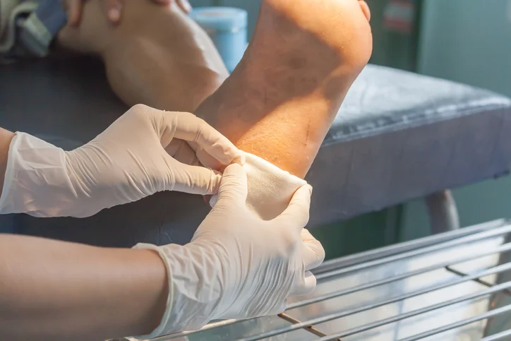 Foot care quiz: Everything you should know about diabetic foot ulcers